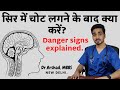 सिर में चोट लगने पर 4 खतरे के संकेत | Sir me chot lagne par kya karna chahiye | Head injury in hindi