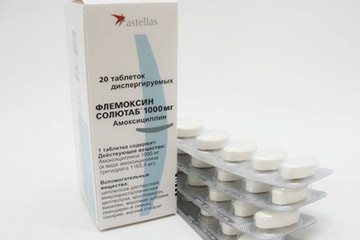 Почему на гландах появляются гнойники? Как вылечить гнойники на миндалинах, если нет повышения температуры
